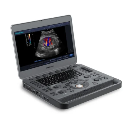 b_x3pro-aparelho-de-ultrassom-port-til-para-diagn-stico-por-imagem-sonoscape